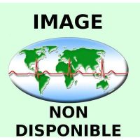 44353-MONITEUR LCD 17 POUCE (SUPPLEMENTAIRE)