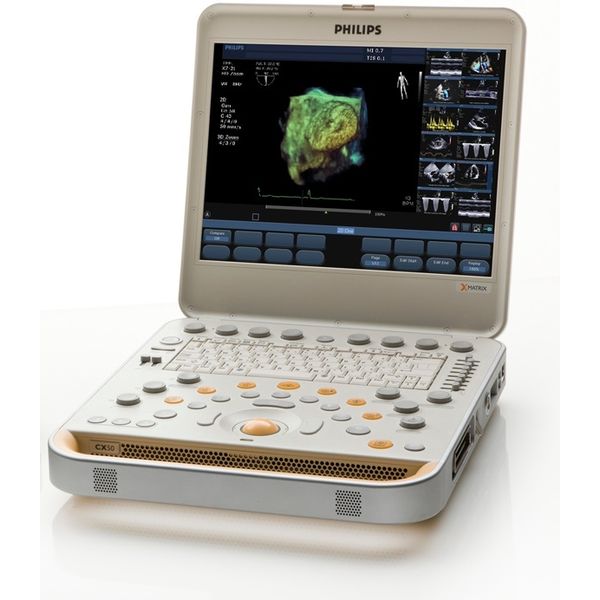 56070-ECHOGRAPHE PORTABLE CARDIAQUE PHILIPS CX50 DOPPLER COULEUR ENERGIE PULSE CONTINU HARMONIQUE RENOVE