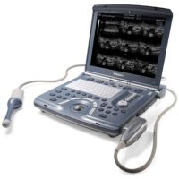 58045-ECHOGRAPHE PORTABLE 4D ABDO-GYNECO GENERAL ELECTRIC VOLUSON i RENOVE