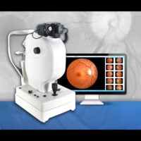 63800-ANGIOGRAPHE CORNEEN FFA