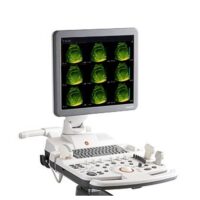 64292-ECHOGRAPHE SONOACE SAMSUNG MEDISON R7 4D OB-GYN RENOVE