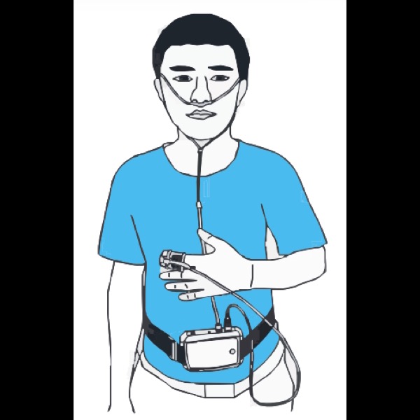 64873-MONITEUR RESPIRATOIRE ET DE SOMMEIL – Image 2